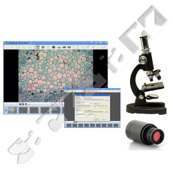  Digitales Foto/Video Okular fr Mikroskope aller Art, 1600 x 1200 Pixel 